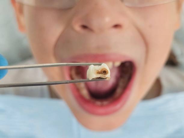 Best Emergency Dental Services for Seniors in Melissa, TX