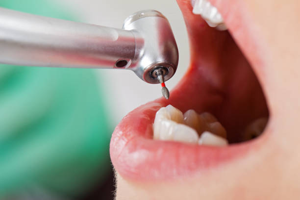 Best Emergency Dental Care for Abscessed Tooth in Melissa, TX